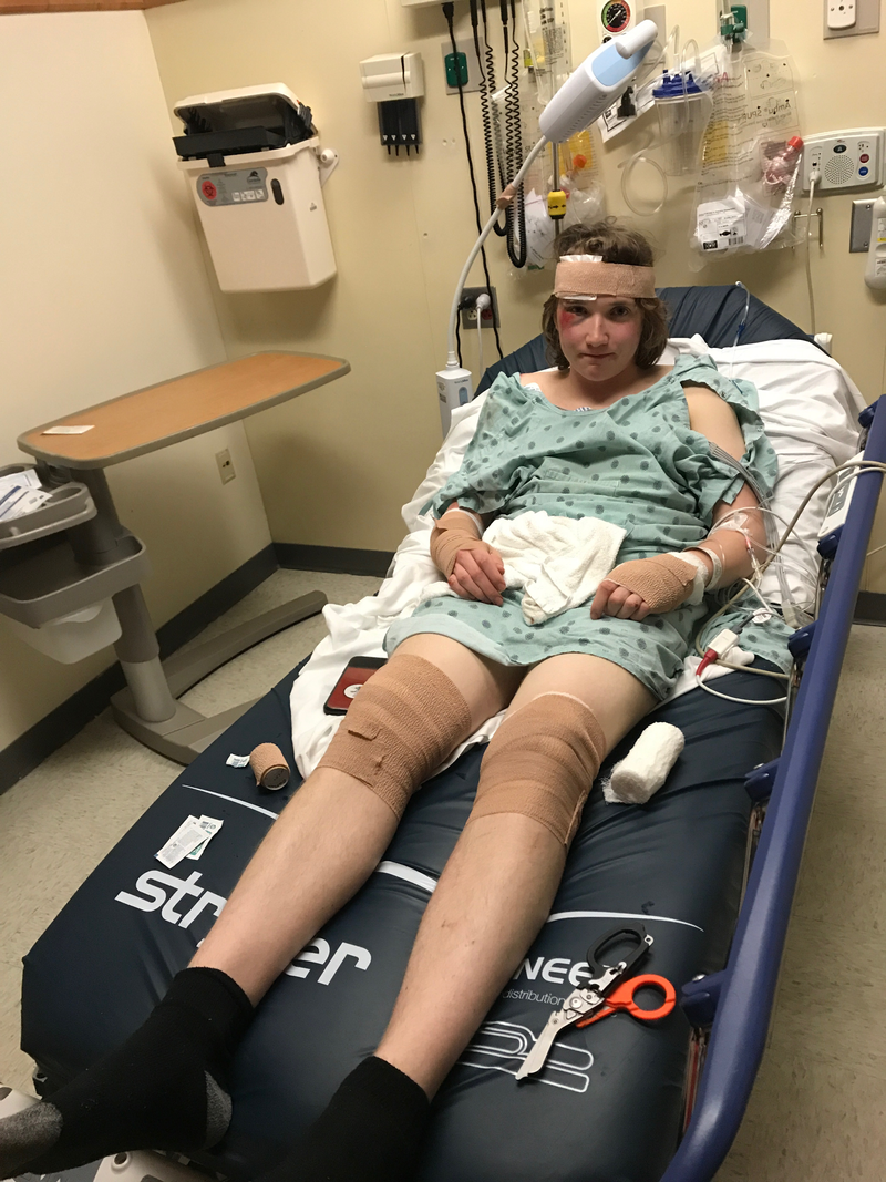 Illustration for article titled I Crashed a Moped and Hurt Myself